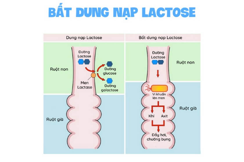 co che khong dung nap lactose